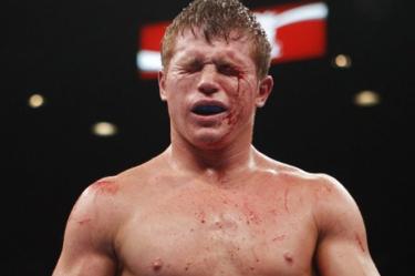 La demanda en contra de 'Canelo' fue impuesta en 2011, pero hace tres semanas comenzó el juicio que terminó con el fallo del jurado en contra del pugilista mexicano (AP)