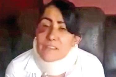thumb