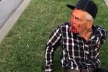 Donan más de 2OO mil dólares para anciano mexicano golpeado en California