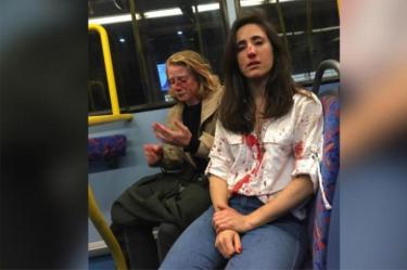 Melania Geymonat publicó en su cuenta de Facebook una fotografía de ella y su novia Chris ambas llenas de sangre. Foto tomada de Facebook