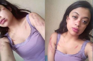 Intentan raptar a estudiante de enfermería; nadie la ayudó