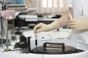 Científicos desarrollan nueva terapia contra la fibrosis quística