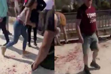 Mexicano agredido pierde riñón; detienen al agresor