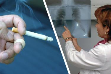 Hoy se conmemora el Día Mundial de la Enfermedad Pulmonar Obstructiva Crónica, el tabaquismo y la contaminación ambiental son los principales factores para padecerla, Atiende IMSS pacientes con EPOC, para 2030 podría ser la cuarta causa de muerte