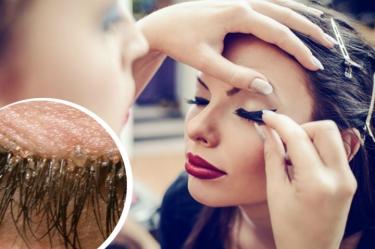 piojos-extensiones-de-pestanas-