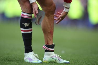 Al final del partido, Cristiano Ronaldo mostró los cortes que le dejaron la última jugada del partido (Fotos: Reuters)