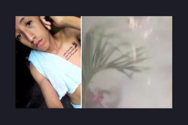 Perdió el brazo 
