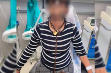 Mujer encadenada del cuello llega a hospital de España.