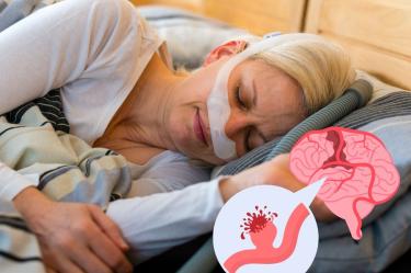 Apnea obstructiva del sueño podría estar relacionada con microhemorragias cerebrales, estudio Foto Canva