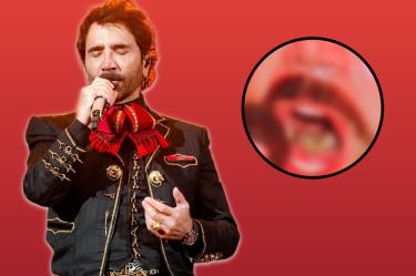 Alejandro Fernández preocupa por el color de su lengua.