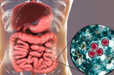 Cyclospora qué es, síntomas además de la diarrea repentina y cómo se transmite