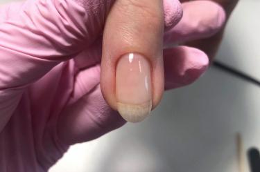 Cómo evitar que la cutícula crezca en exceso