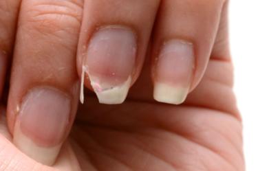 Remedios para reparar uñas dañadas por acrílico