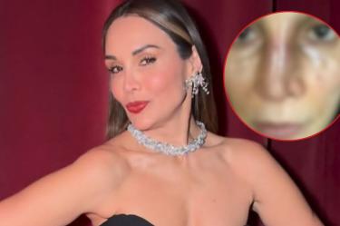 Tanya Vázquez deja Sale el Sol por una cirugía
