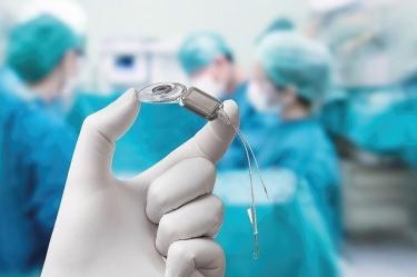 Un profesional sanitario sostiene un implante coclear durante un procedimiento médico, mientras varios especialistas trabajan en un quirófano.