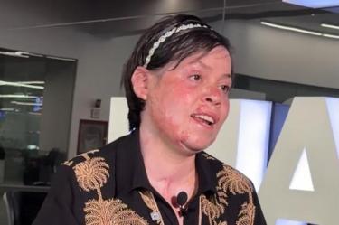 Janeth Guadalupe, de 22 años, sobrevivió a la explosión en La Concordia.Juan Dimas
