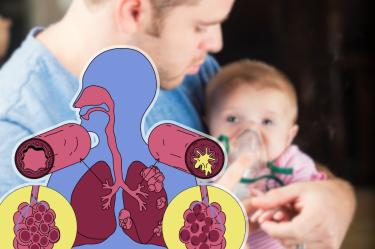 ¿La fibrosis quística es hereditaria?