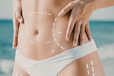 Remodelación de cintura sin incisiones: La innovación ecoguiada que transforma la cirugía estética