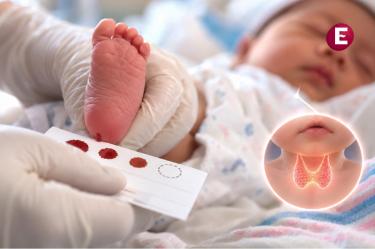 Tamiz neonatal mediante prueba de sangre en un recién nacido para detectar hipotiroidismo congénito