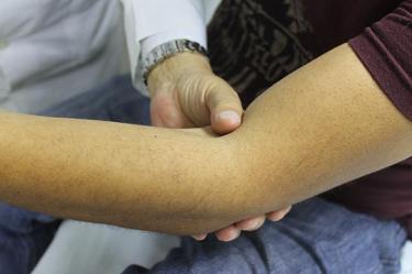 La hemofilia afecta la capacidad de la sangre para coagular adecuadamente