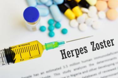 ¿Cuánto vive el virus del herpes zóster fuera del cuerpo y cómo prevenir su contagio?