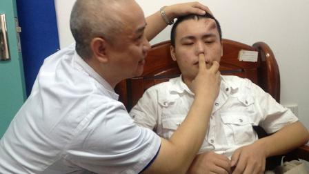 En la frente de Xiaolian, de 22 años, fue 'cultivada' una nariz para serle trasplantada después de que sufriera un grave accidente automovilístico. / Foto: Reuters