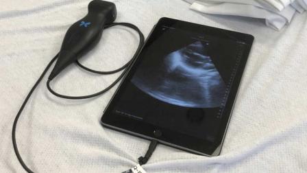 Aparato ultrasónico acomplado a una tableta fotografiado en una cama de la facultad de medicina de la Universidad de Indiana en Indianápolis el 2 de agosto del 2019. El aparato muestra imágenes instantáneas del corazón y de otros órganos, y ayuda a los médicos a hacer diagnósticos. (AP Photo/Lindsey Tanner)