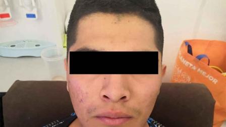 El delincuente usaba un arma de juguete para asaltar unidades de transporte público, por las mañanas. Foto: Especial