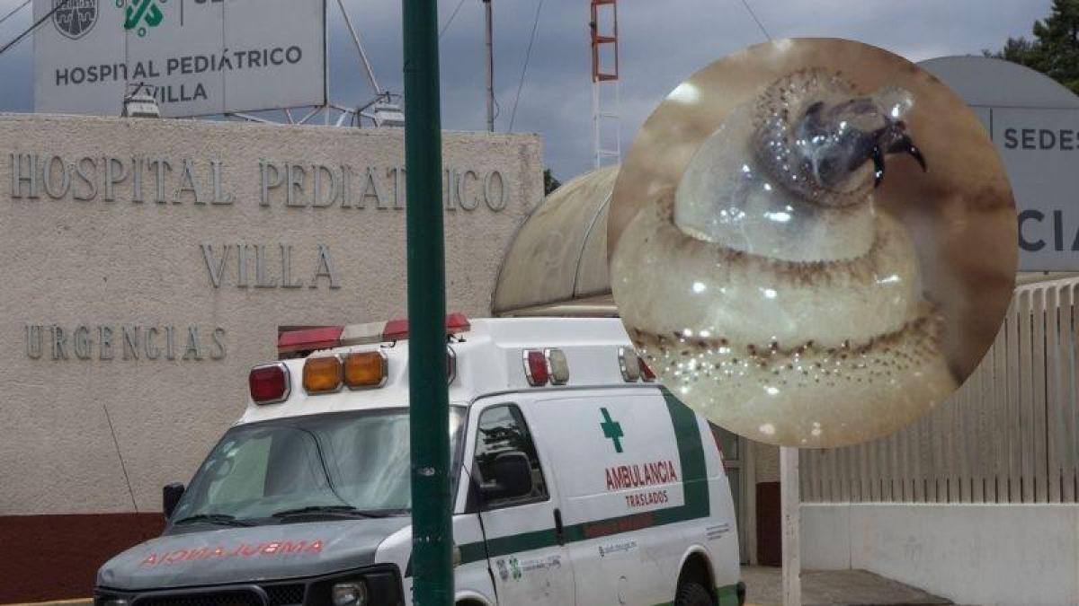 <![CDATA[Atienden a tres personas en CDMX por gusano barrenador]]>