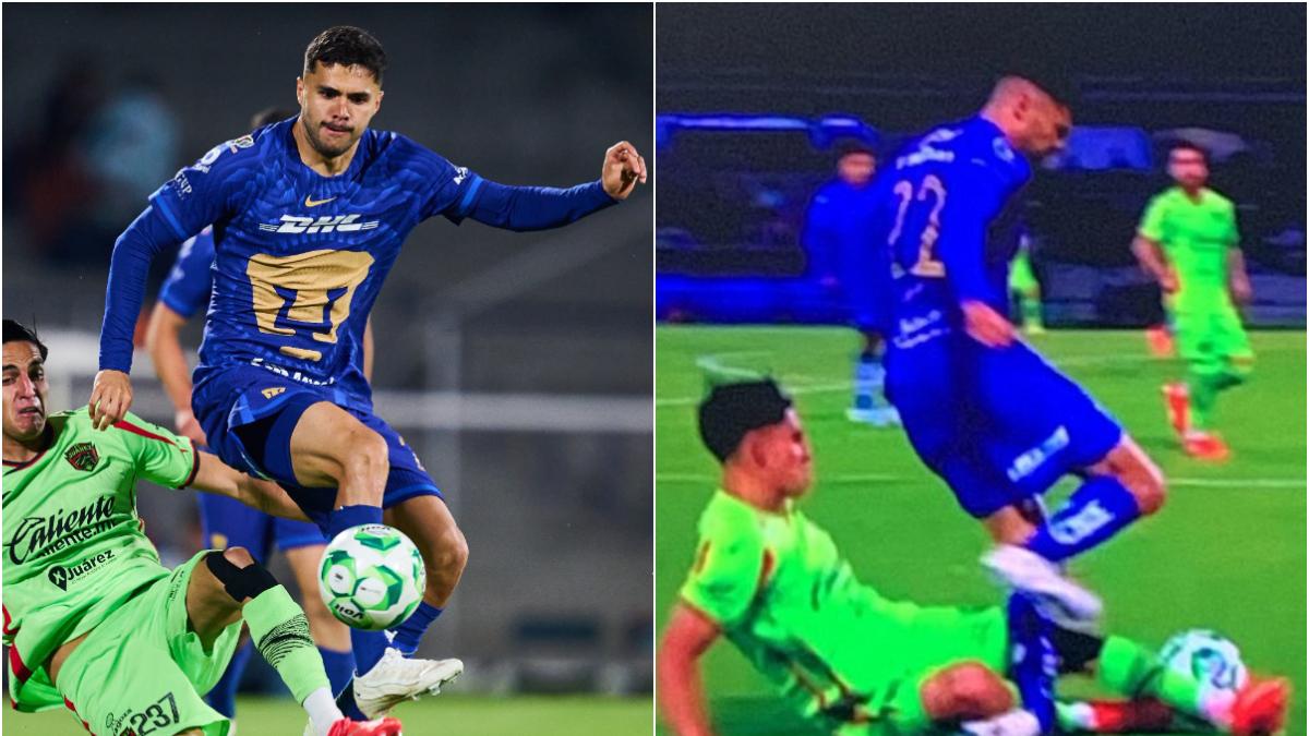 <![CDATA[¡Imágenes fuertes! Alan Medina sufre escalofriante lesión en el Pumas vs FC Juárez]]>