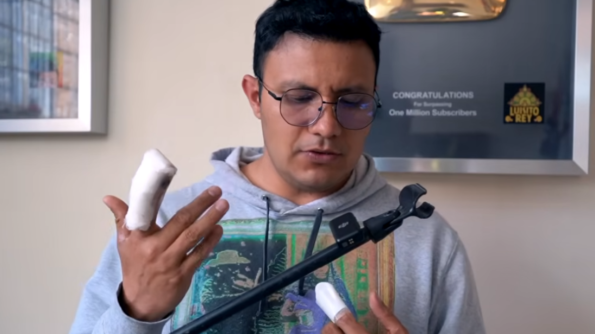 <![CDATA[¿Qué es un carcinoma, el cáncer que le dio a Luisito Rey?]]>