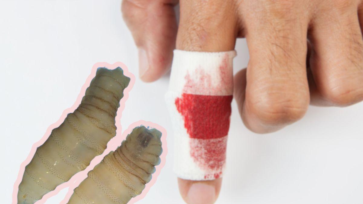 Síntomas del gusano barrenador en humanos